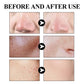 West & Month Blackhead Removal Mud Mask