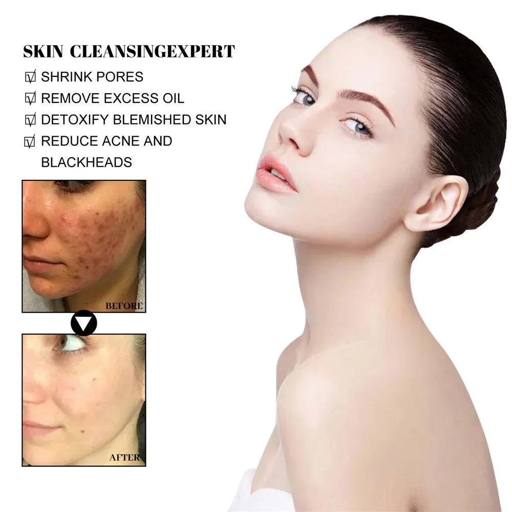 West & Month Blackhead Removal Mud Mask